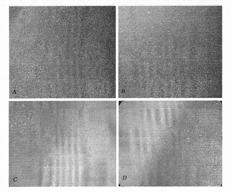 Method for largely expanding late endothelial progenitor cells from peripheral blood