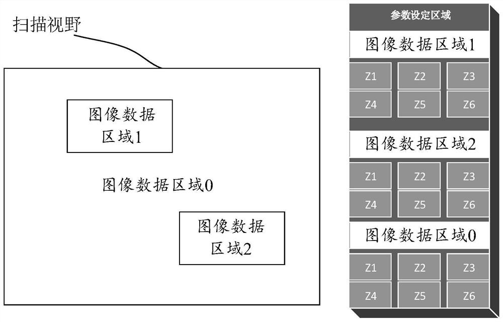 CT image data acquisition method and device and computer equipment