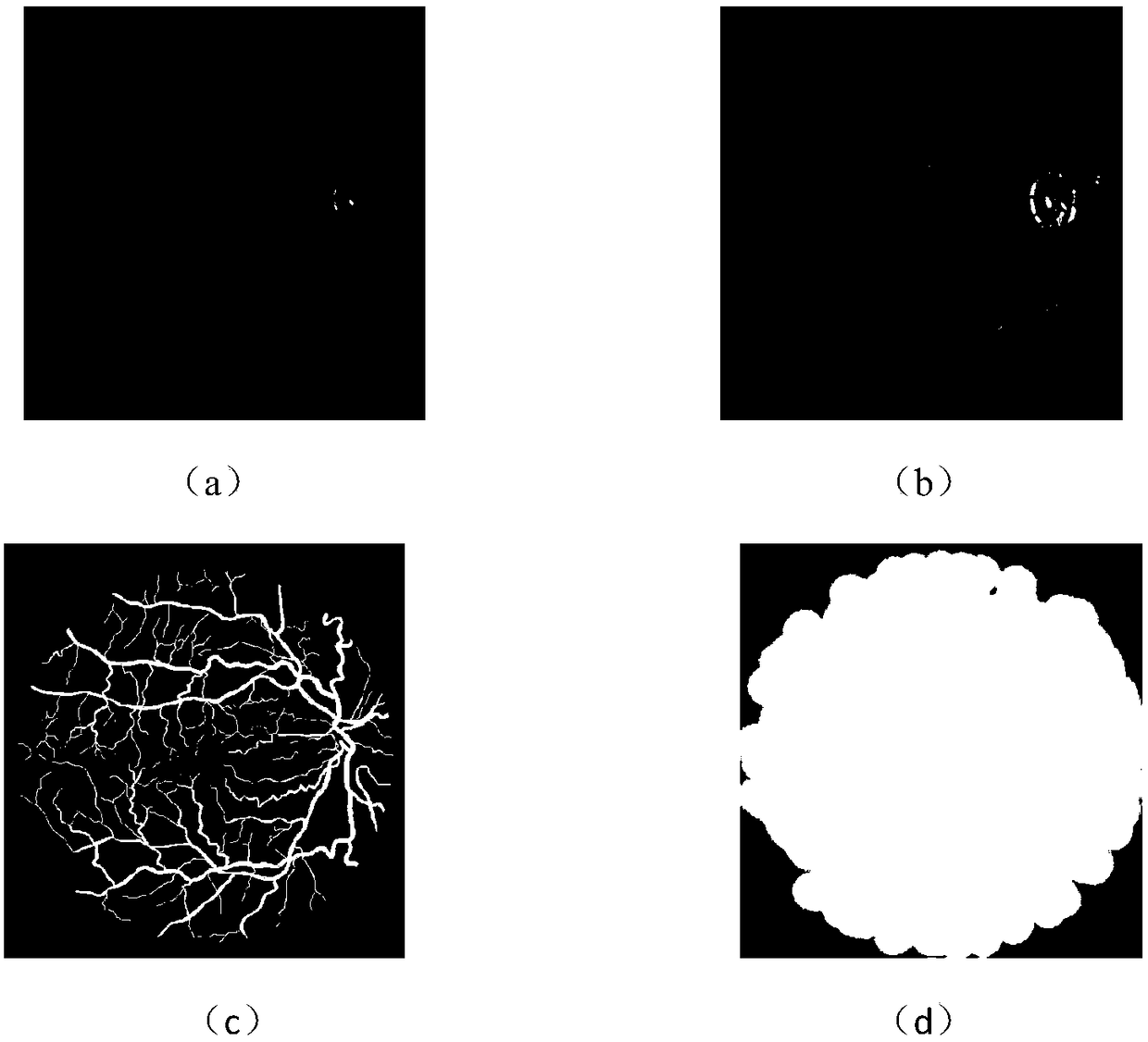 Iterative eye fundus image blood vessel segmentation method based on distance modulation loss