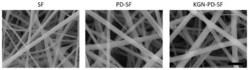 Drug-loaded KGN nanofiber scaffold and preparation method and application thereof