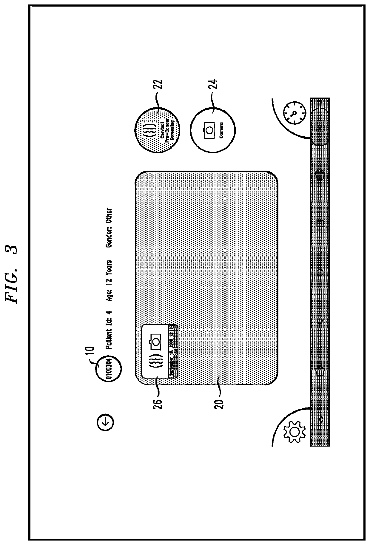 Automated Process For Controlling In Vivo Examination Of The Cervix And Collecting Image Data Related Thereto