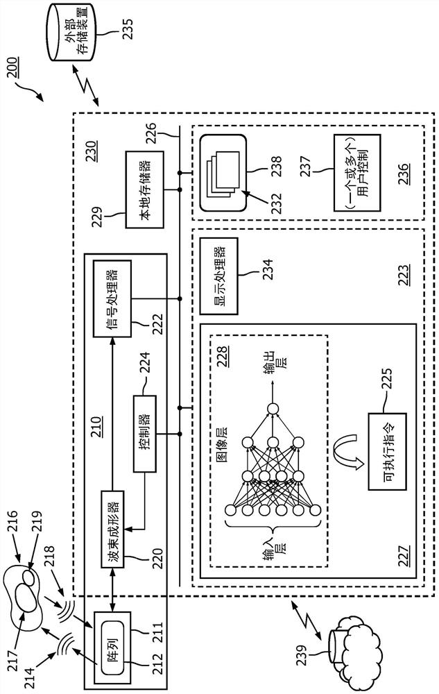 Ultrasound system with an artificial neural network for guided liver imaging