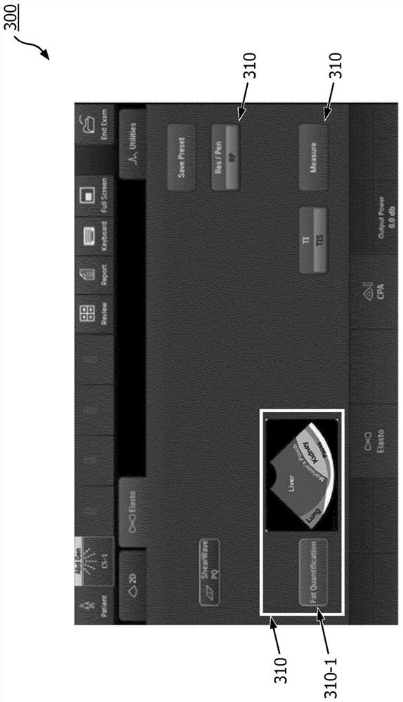 Ultrasound system with an artificial neural network for guided liver imaging