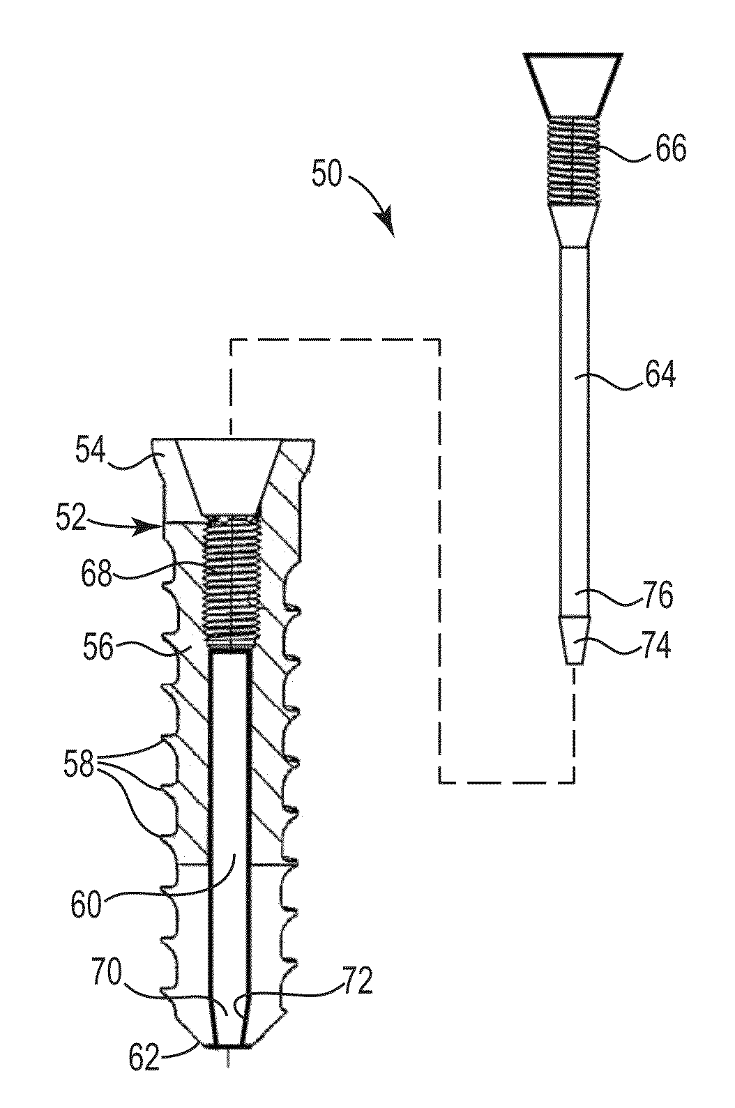Fixation system for orthopedic devices