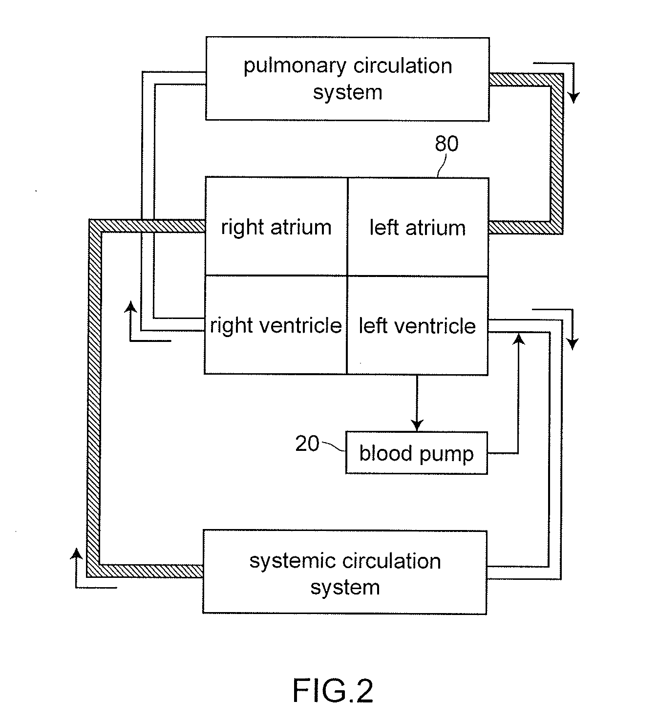 Artificial heart device