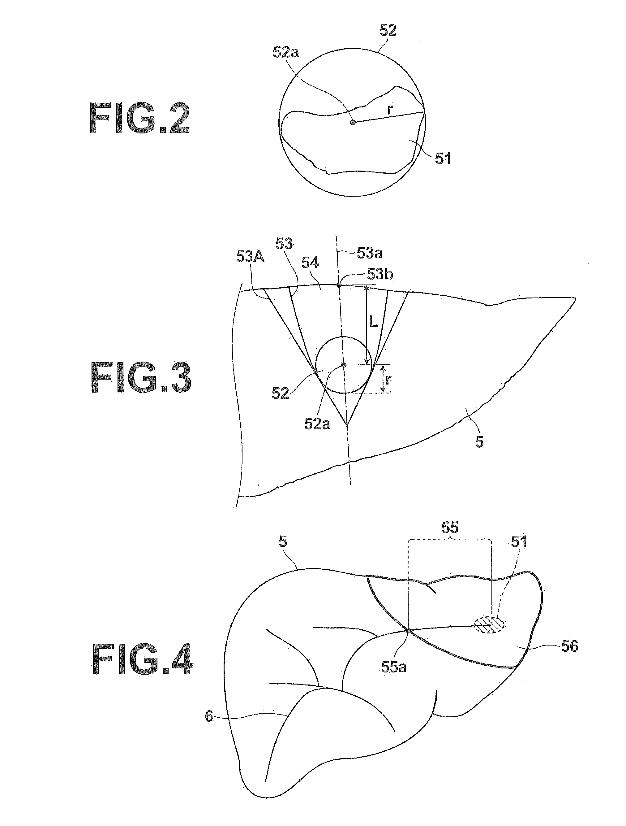 Surgery assistance apparatus, surgery assistance method and non-transitory computer-readable recording medium having stored therein surgery assistance program