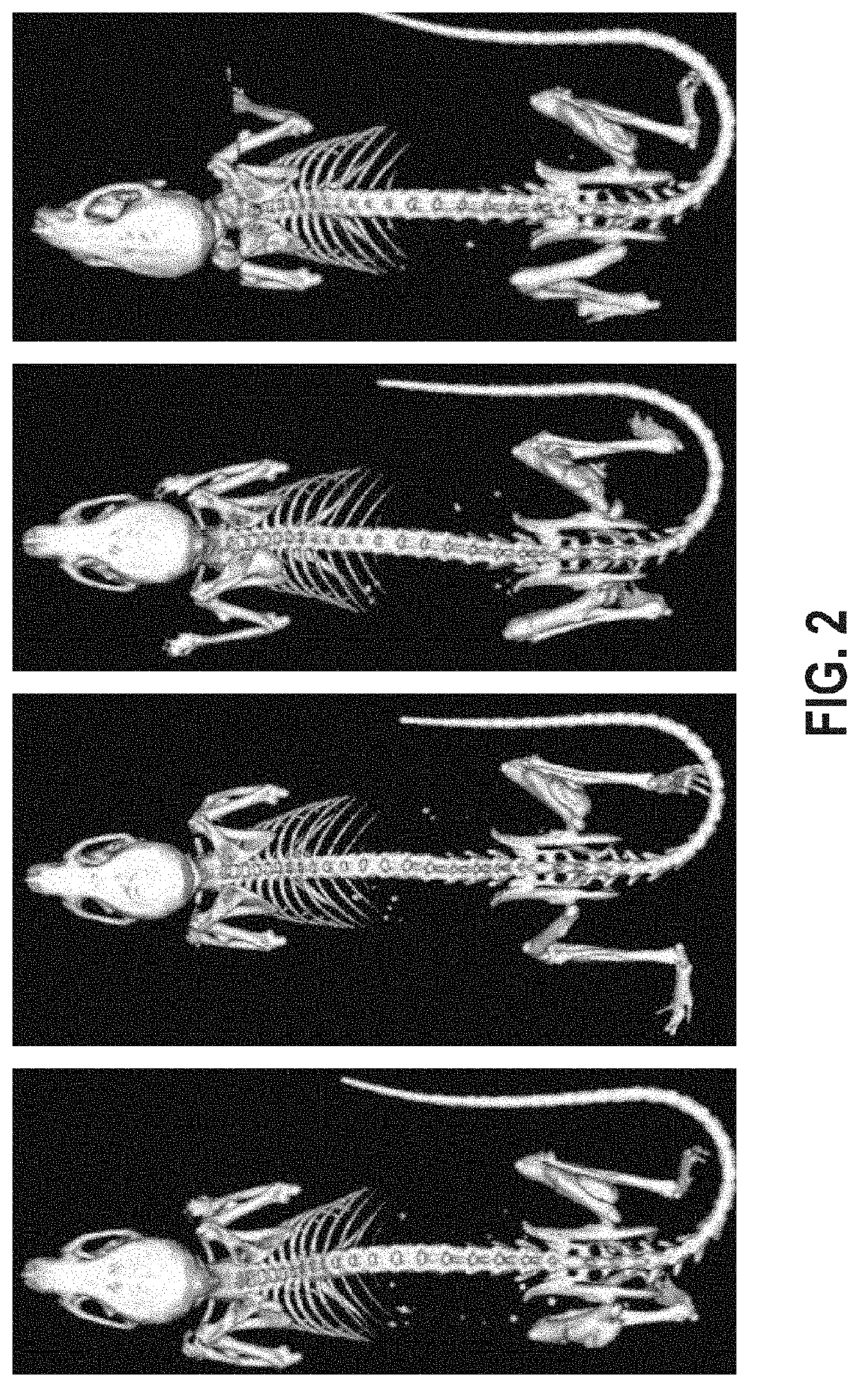 Genetically modified rodent with an inducible ACVR1 mutation in exon 7 that causes ectopic bone formation