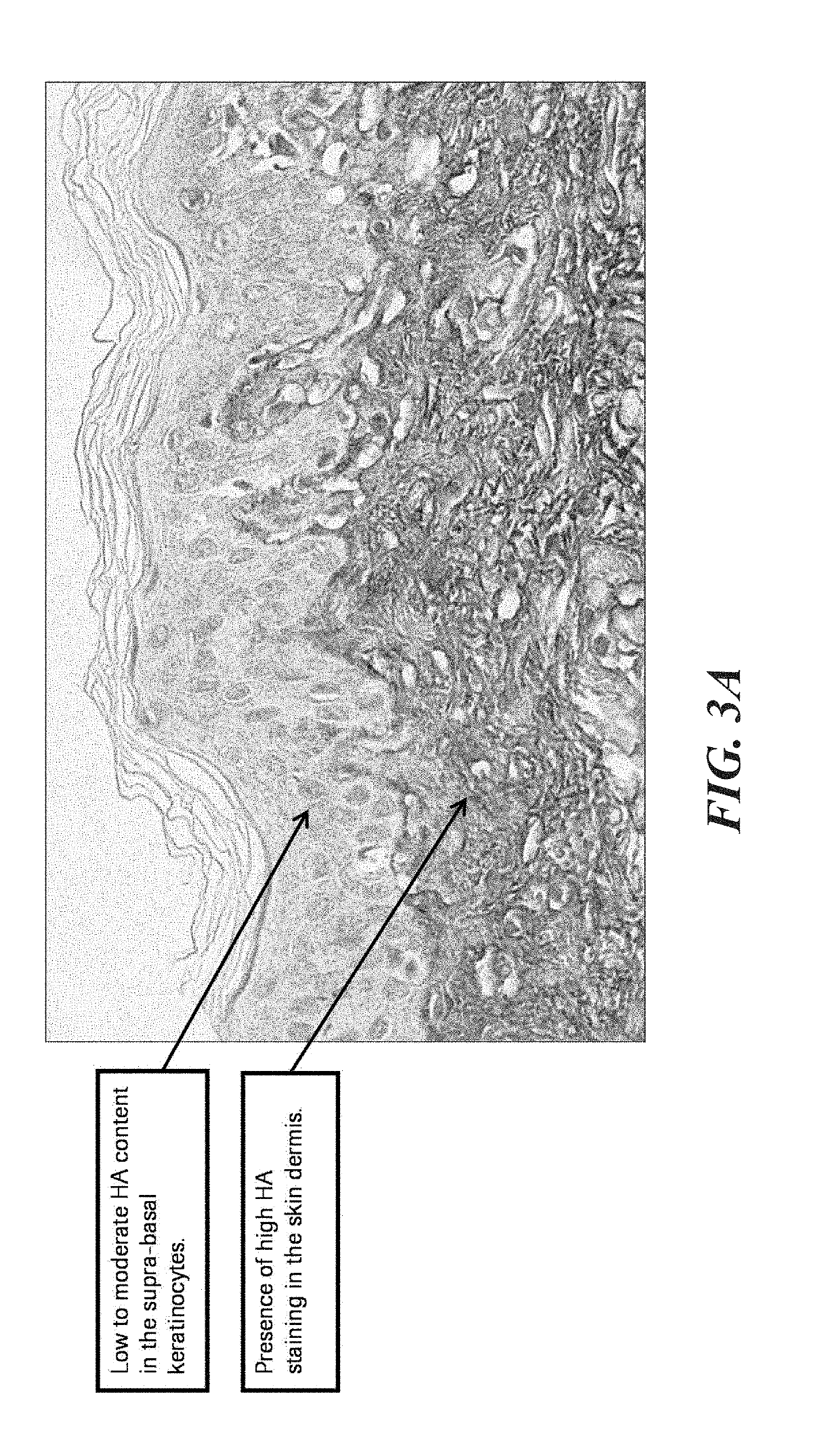 Methods and systems for scoring extracellular matrix biomarkers in tumor samples