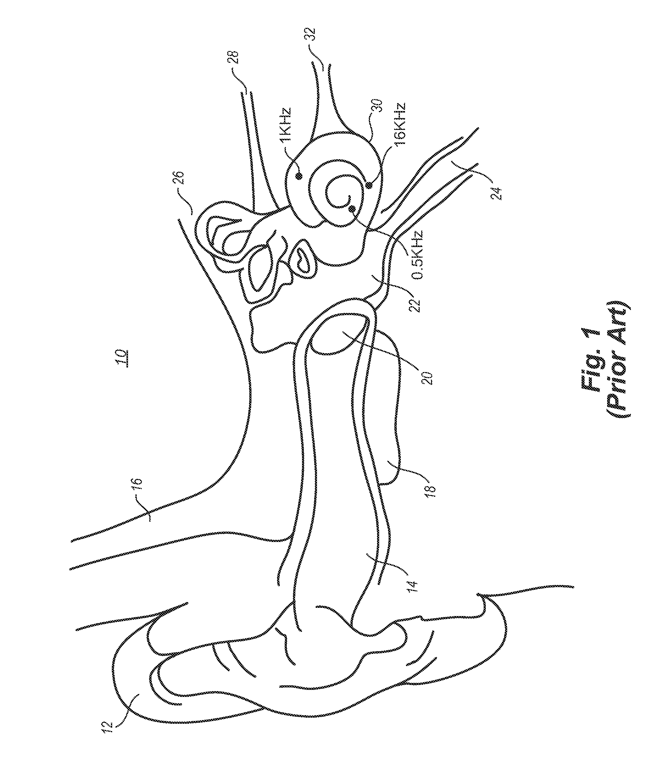 Localized therapeutic hypothermia system, device, and method