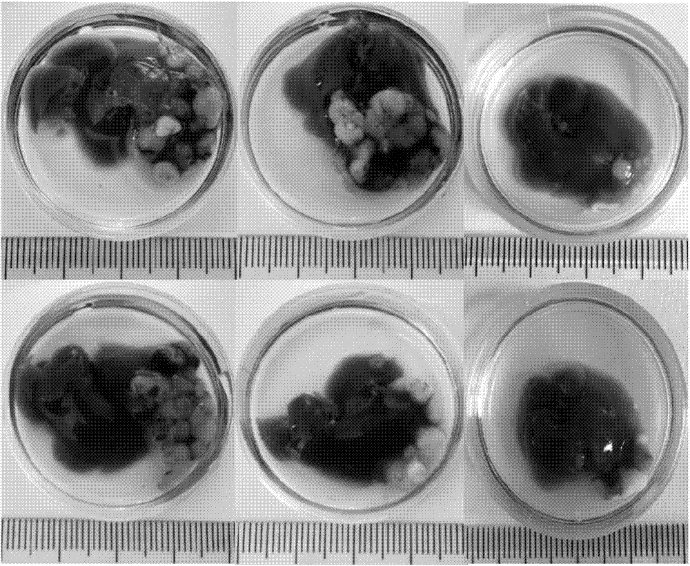 Method for establishing liver cancer xenograft tumor model based on liver cancer circulating tumor cell biological gel hanging-drop culture technology