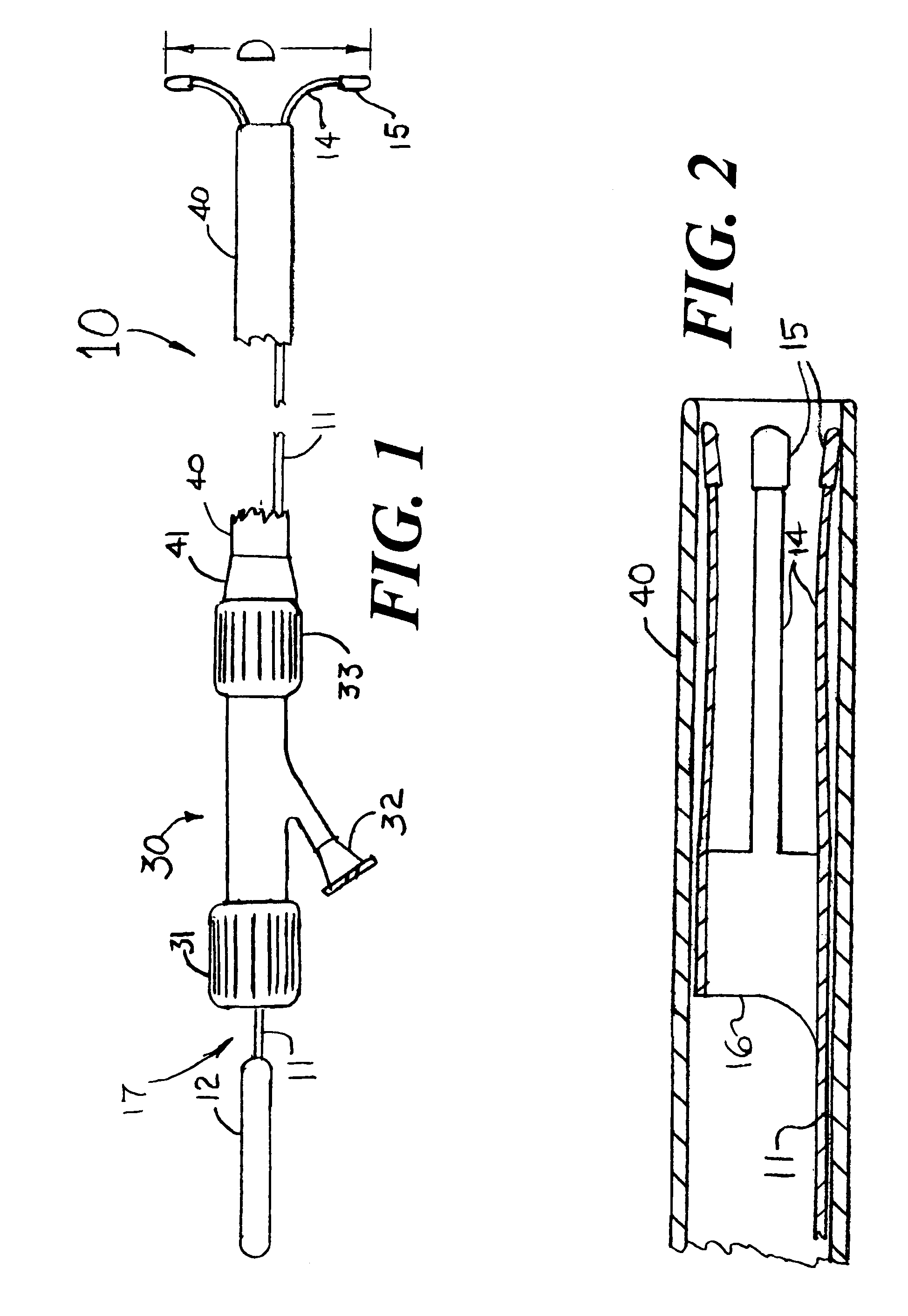 Means and method for the accurate placement of a stent at the ostium of an artery