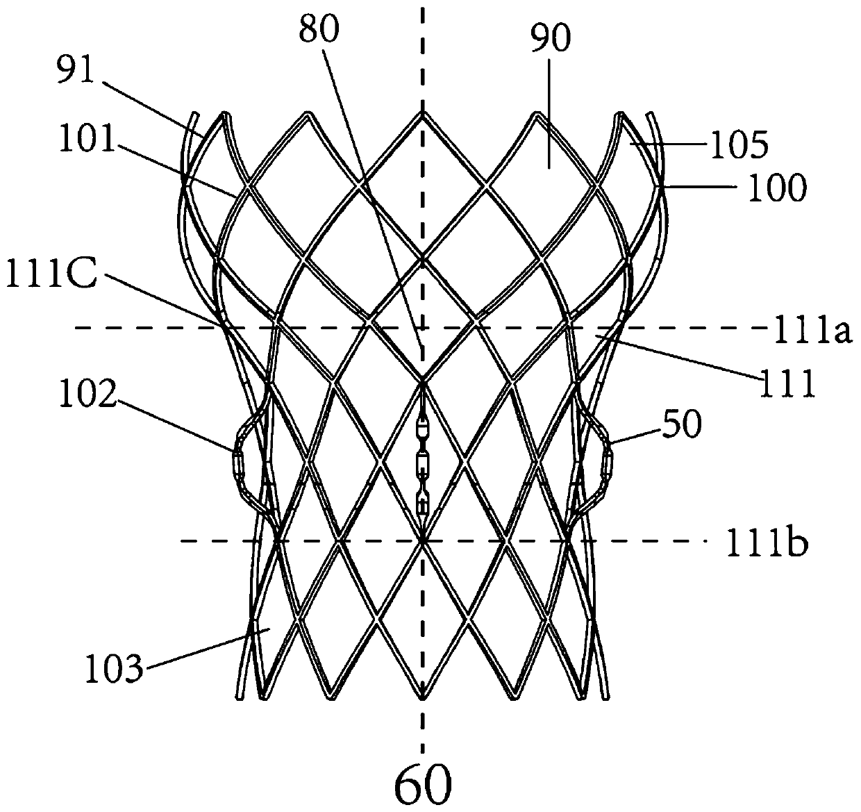 Transcatheter aorta valve implanting device with attached structure