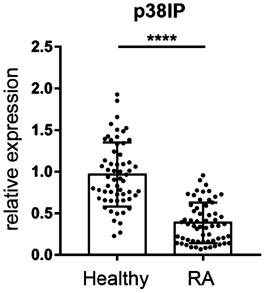 Rheumatoid arthritis diagnostic marker and application thereof