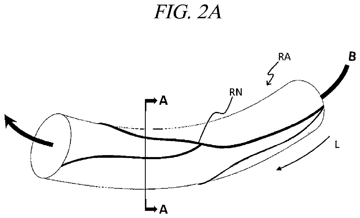 Systems and methods for perivascular nerve denervation
