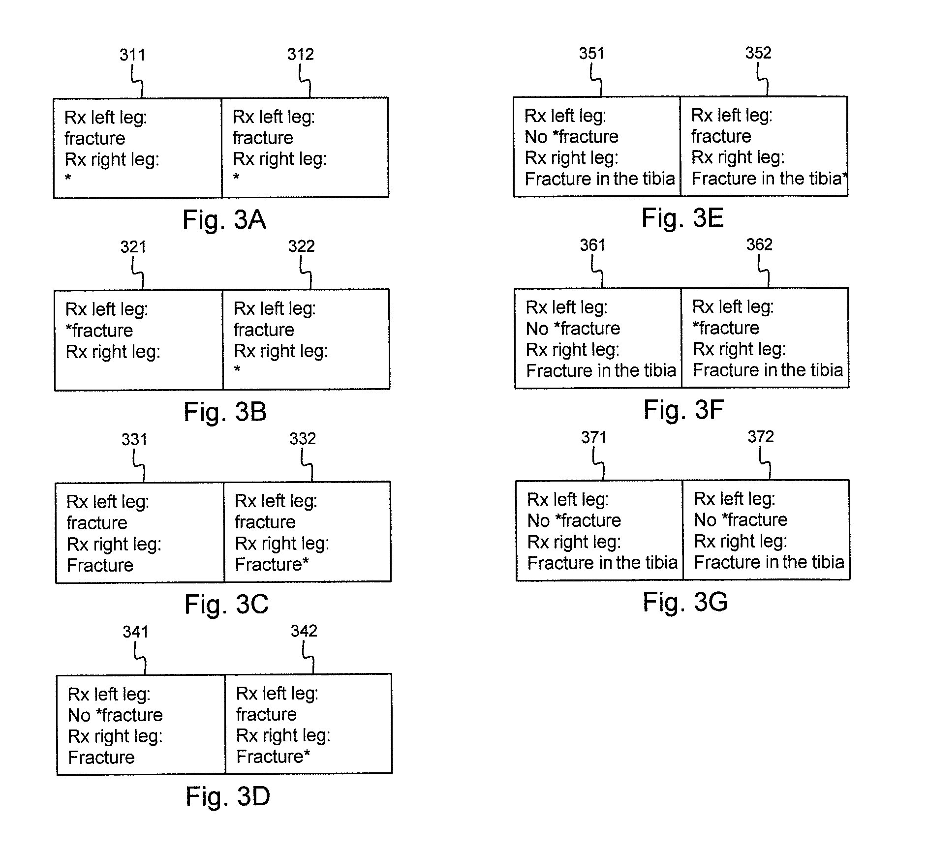 Speech recognition method and system with simultaneous text editing