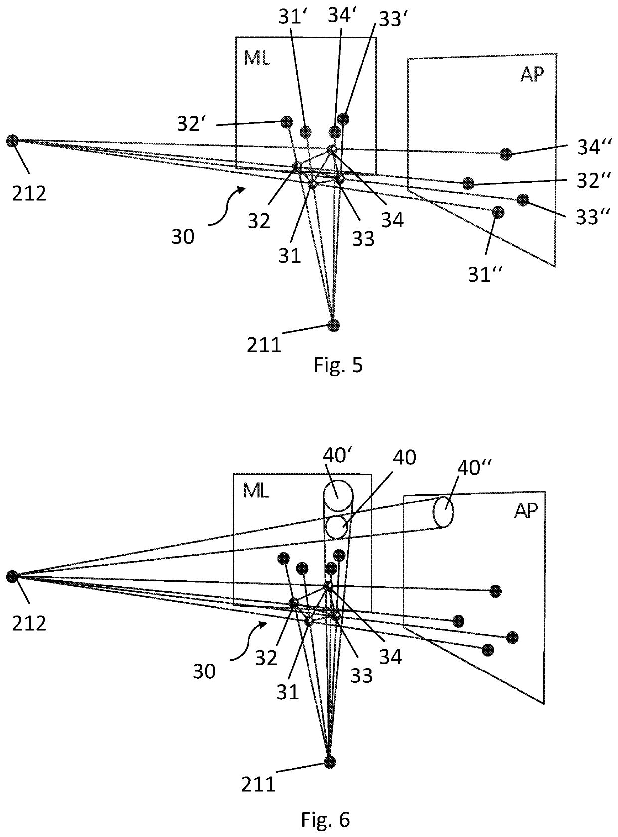 Device for determining the anteversion angle