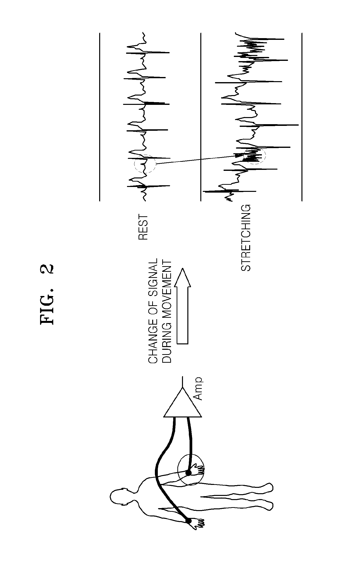 Electrode for measuring bio potential, method of manufacturing the electrode, and system for measuring physiological signal