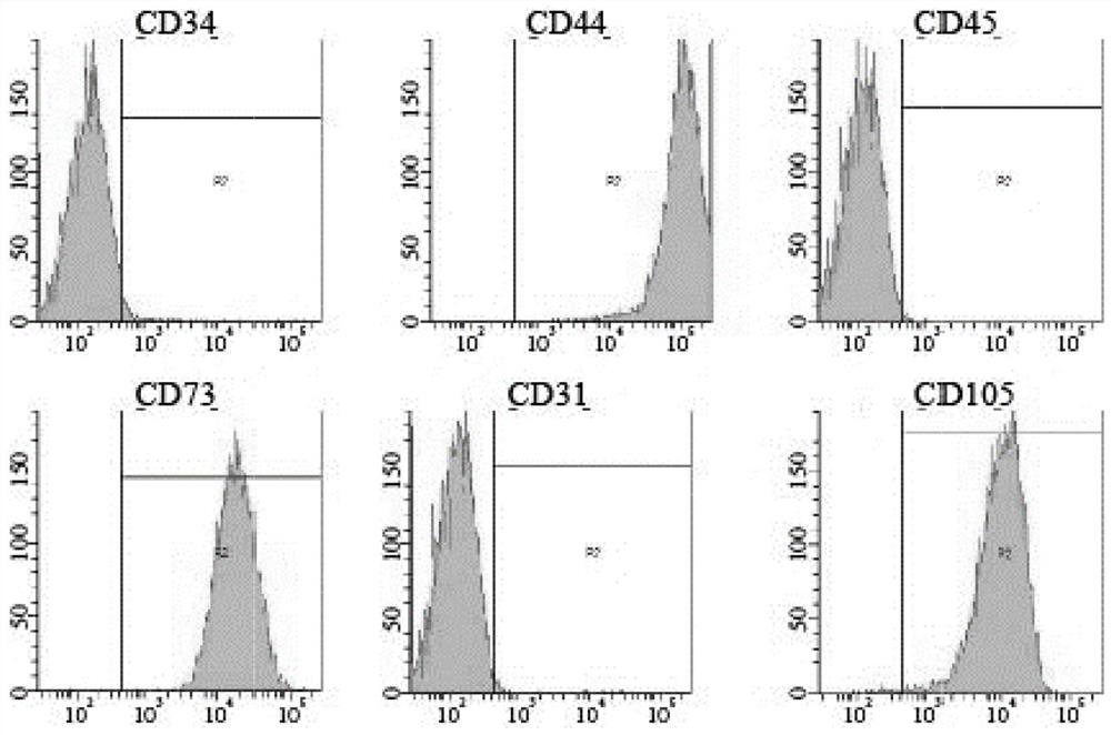 Screening and identifying method and application of amniotic stem cell exocrine protein