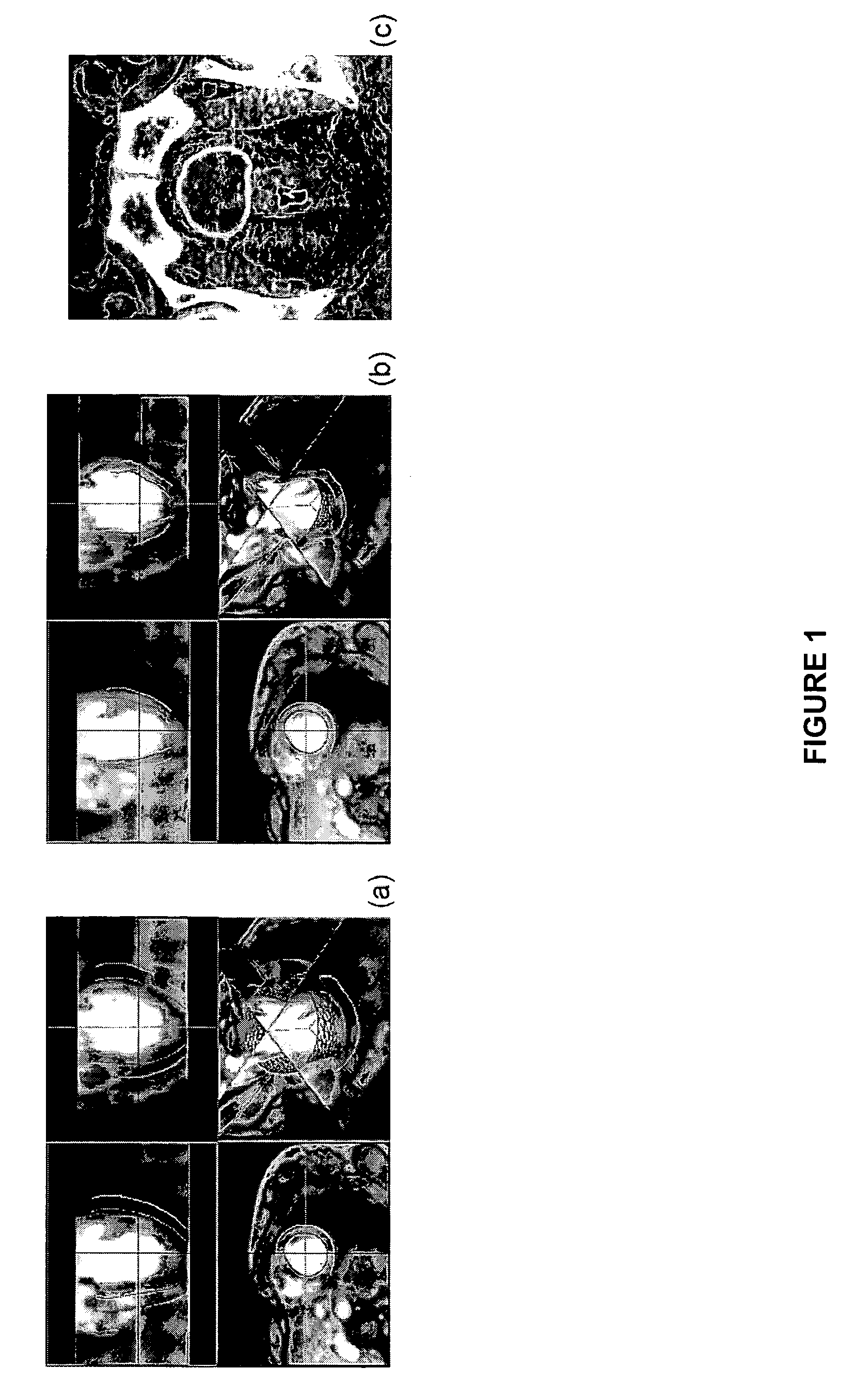 System and methods for image segmentation in n-dimensional space
