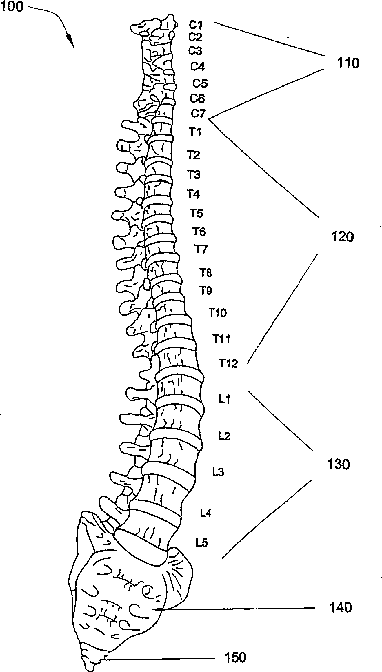 Laminoplasty devices and methods
