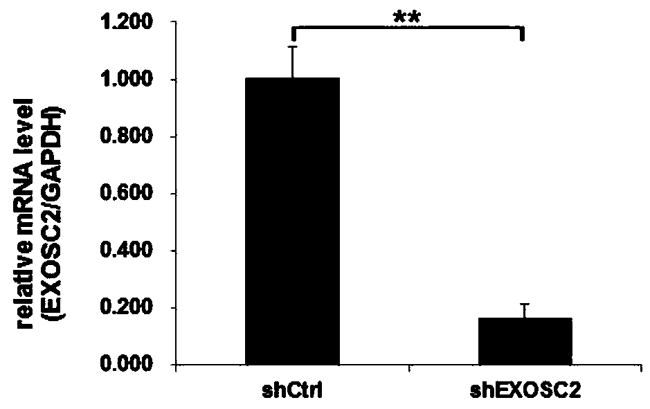 Application of human EXOSC2 gene and related product