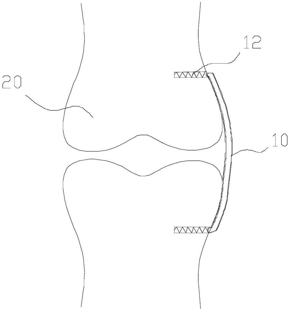 Artificial ligament and artificial ligament assembly