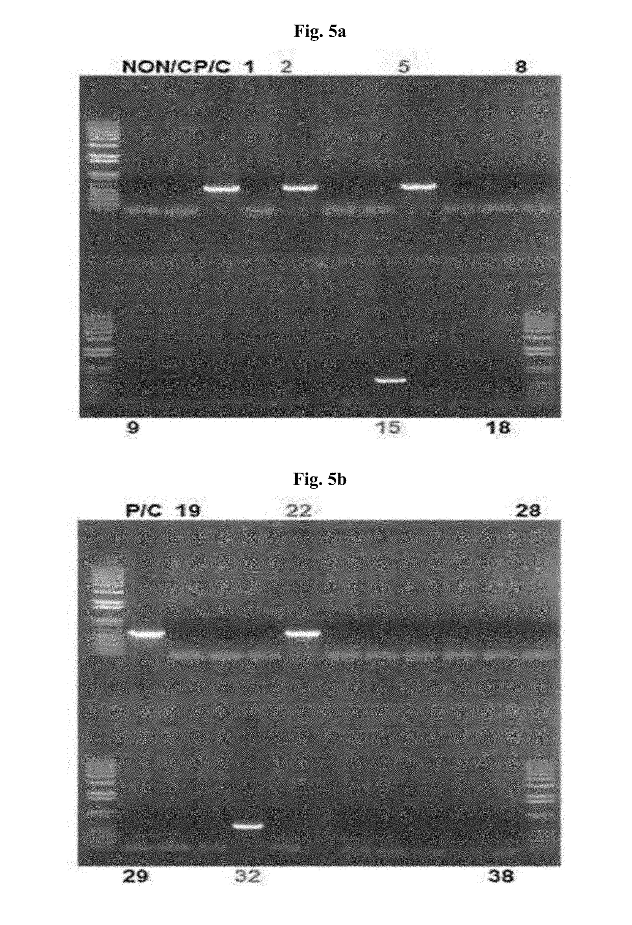 Transgenic mouse expressing inactivated human iduronate-2-sulphatase and method for improving a hunter syndrome treating agent using same