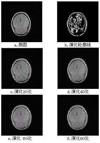 Multi-target image segmentation C-V method based on area division and gradient guiding