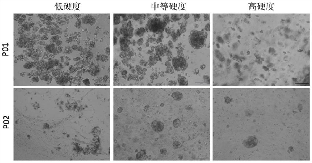 Culture method and application of human colorectal cancer tissue organoid