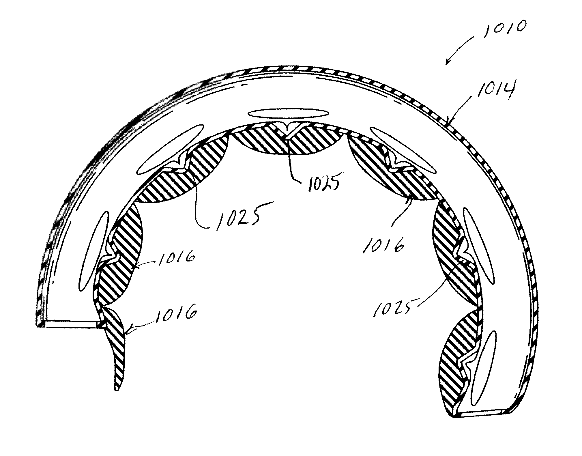 Mechanical gastric band with cushions