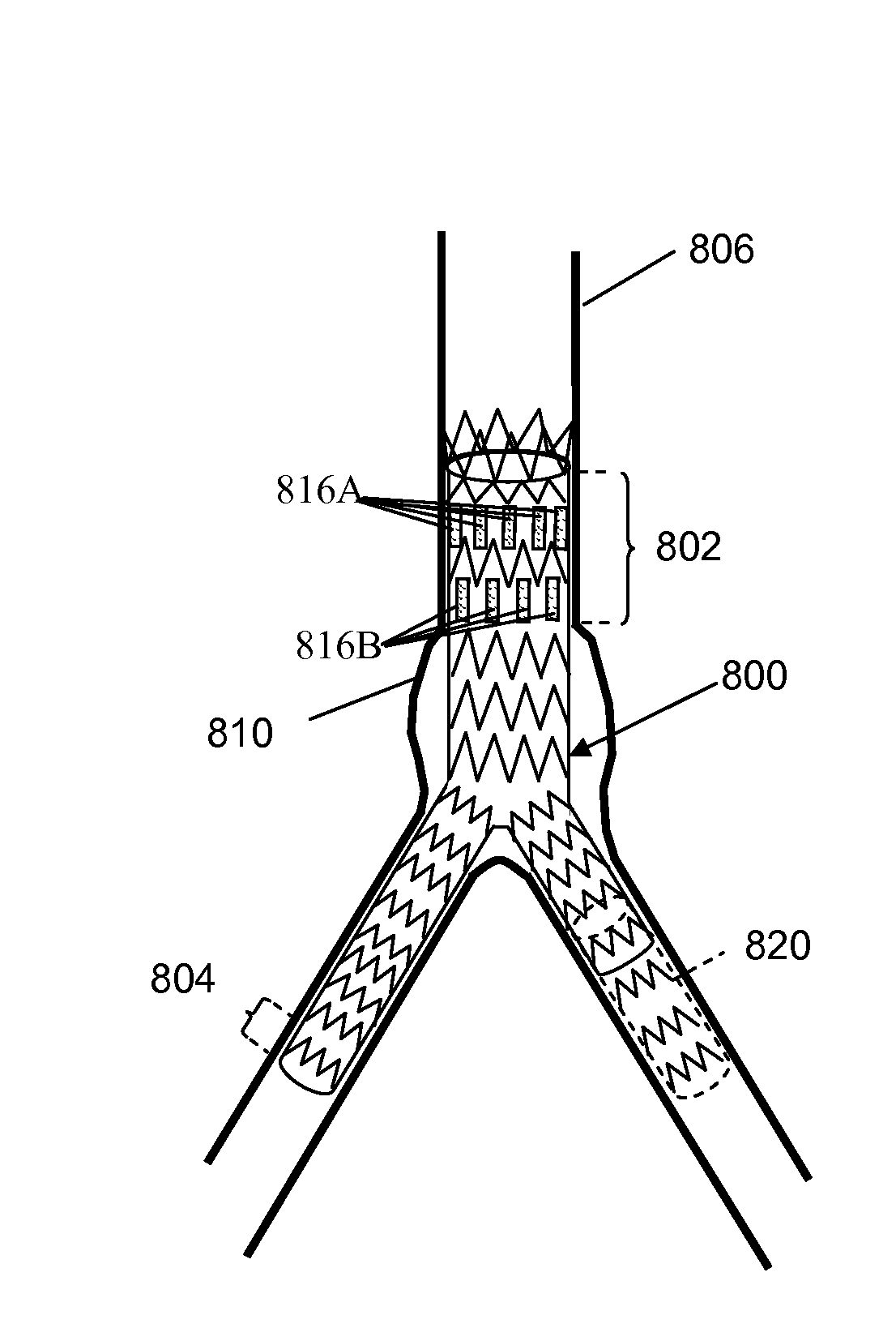 Stent Graft With Strips to Promote Localized Healing