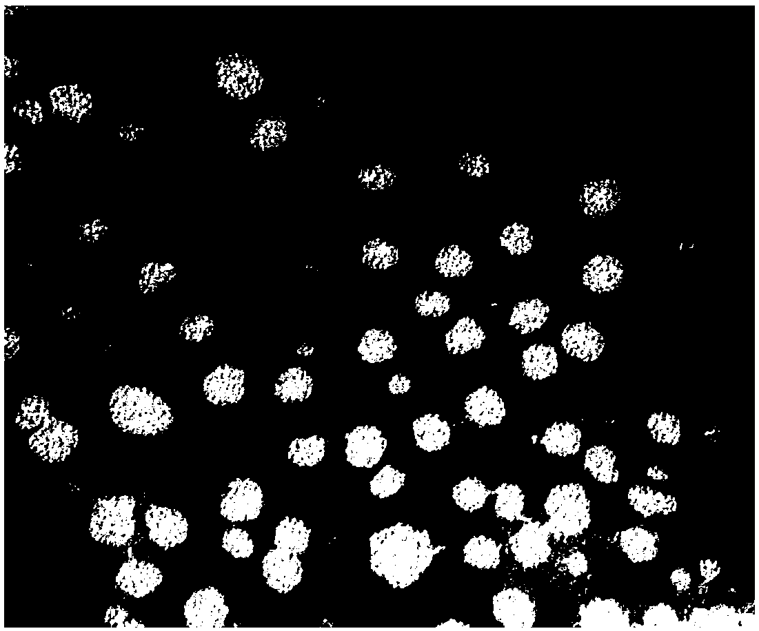 Asiatic acid-chitosan-deoxycholic acid (AA-CS-DCA) micelles and preparation method thereof