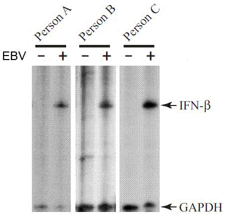 Induction method of massive individualized natural interferon