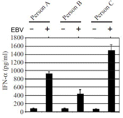 Induction method of massive individualized natural interferon