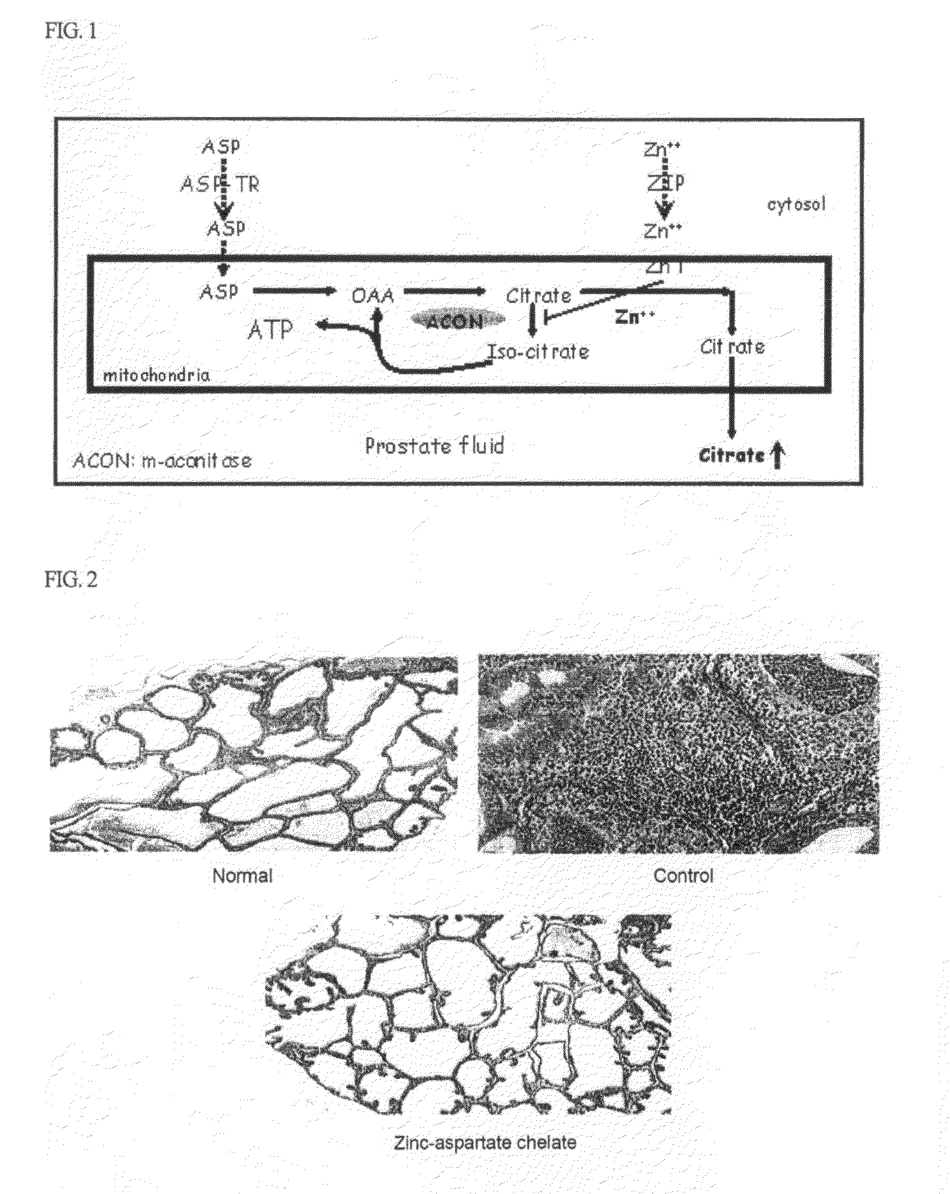 Composition containing metal-acidic amino acid chelate accelerating absorption of metal