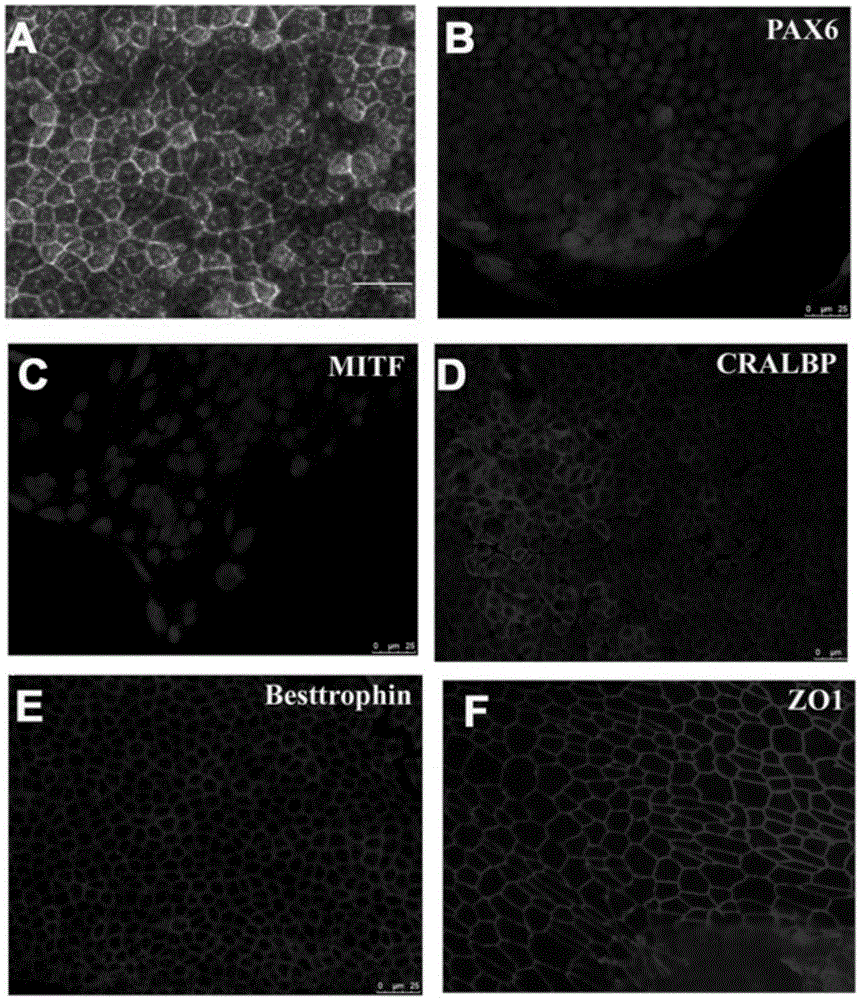 Method for inducing human embryonic stem cells to be differentiated into retinal pigment epitheliums (RPE) in vitro