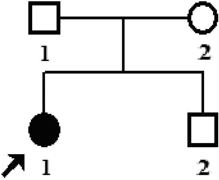 CYP4V2 gene mutant and application thereof