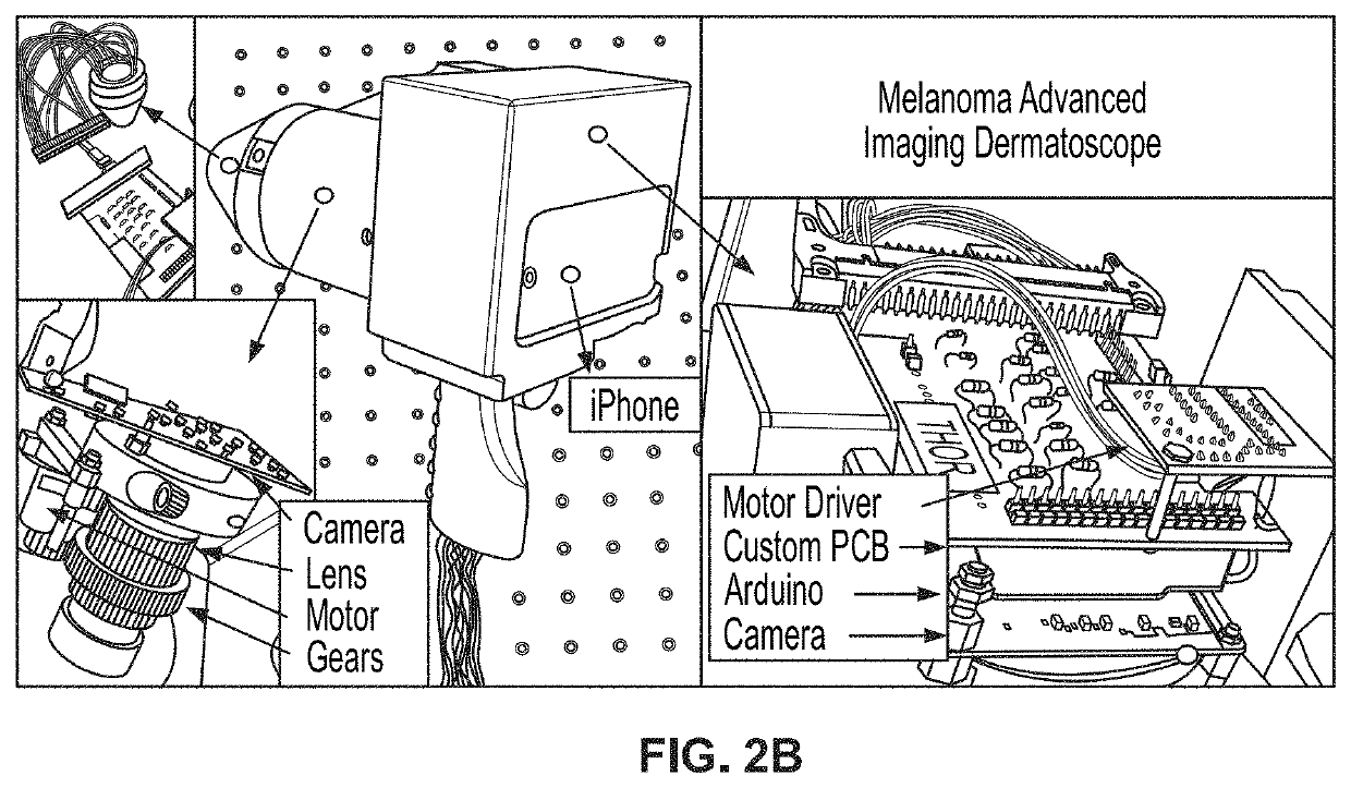 Hyperspectral imaging in automated digital dermoscopy screening for melanoma