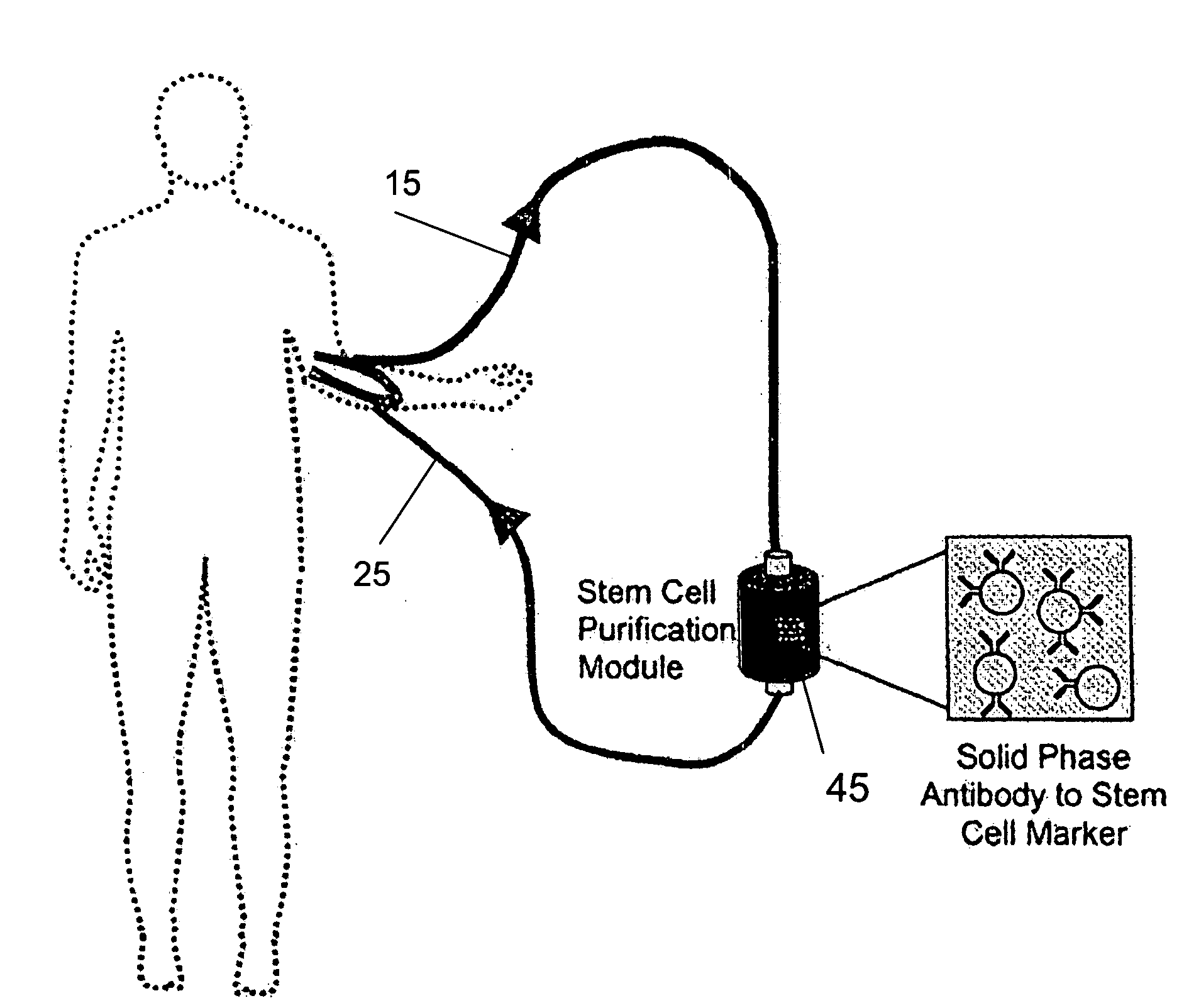 Isolating and purifying cells for therapy