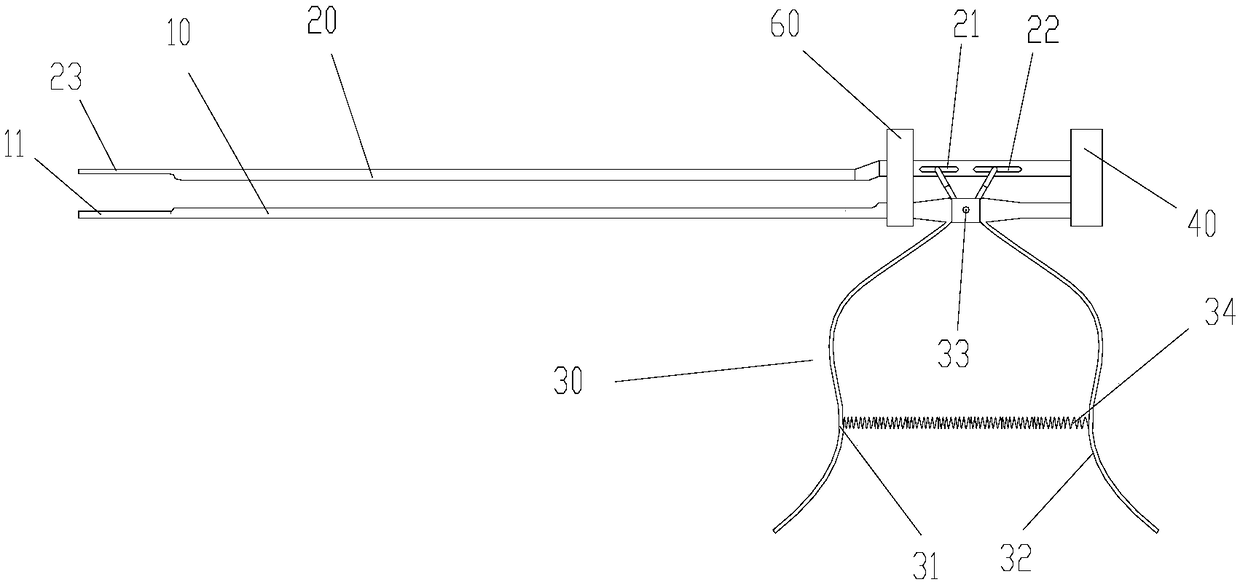 Medullary embolus extraction forceps