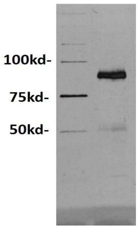 Bispecific antibody fitc×cd3 and its preparation method and application