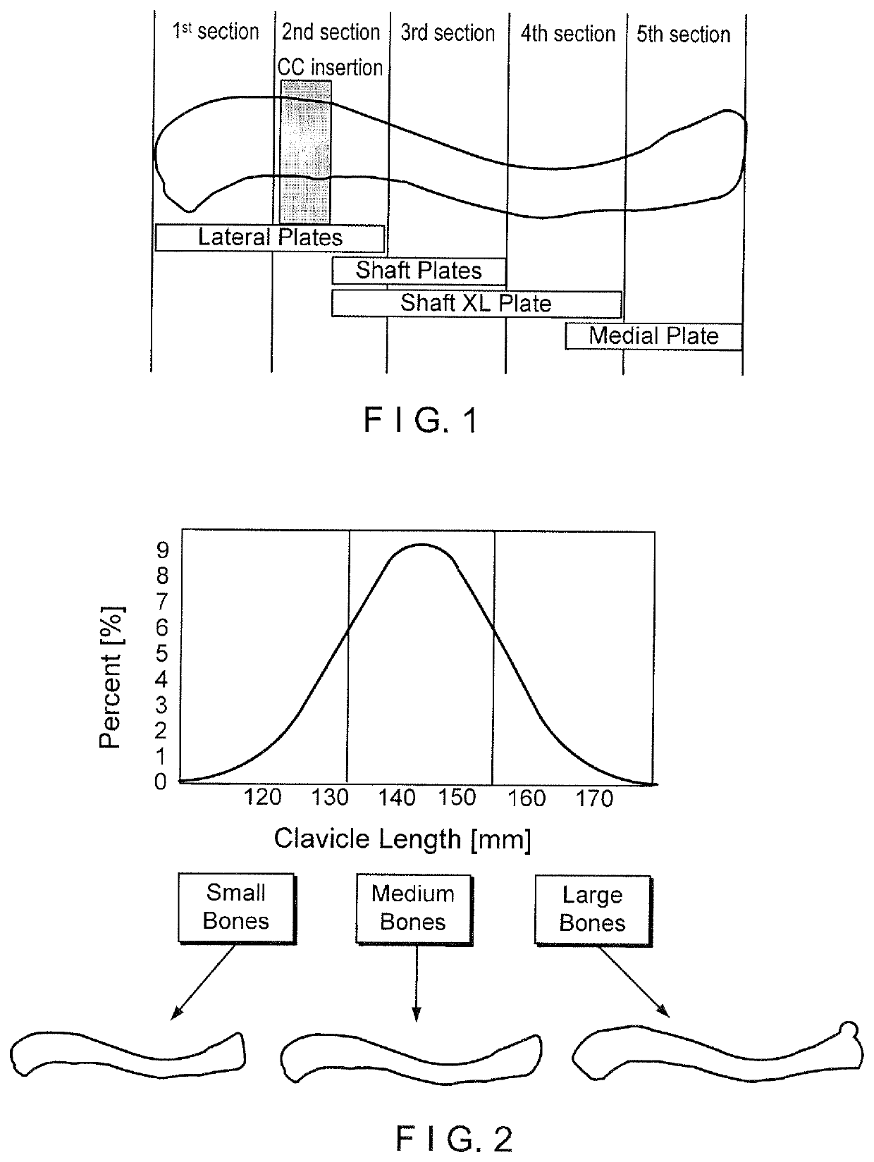 Clavicle segmental plate system