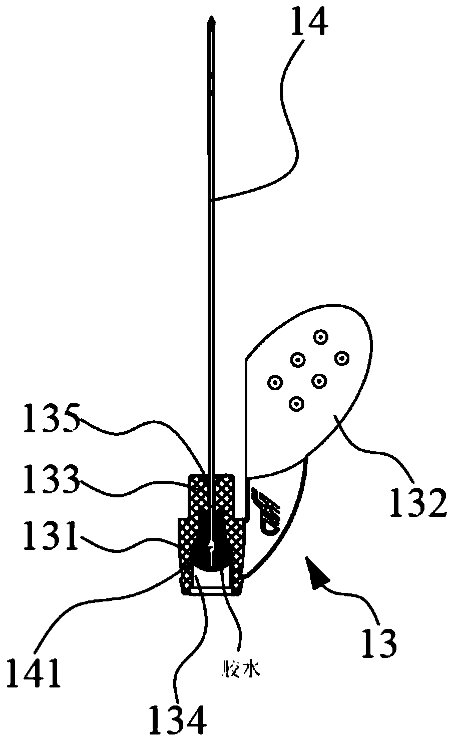 Indwelling needle and assembling process thereof