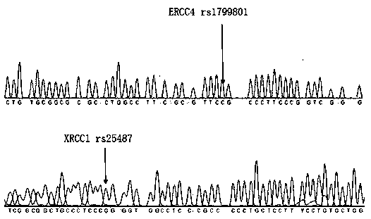 A set of primers capable of simultaneously detecting ERCC4 and XRCC1 genetic polymorphism, and applications