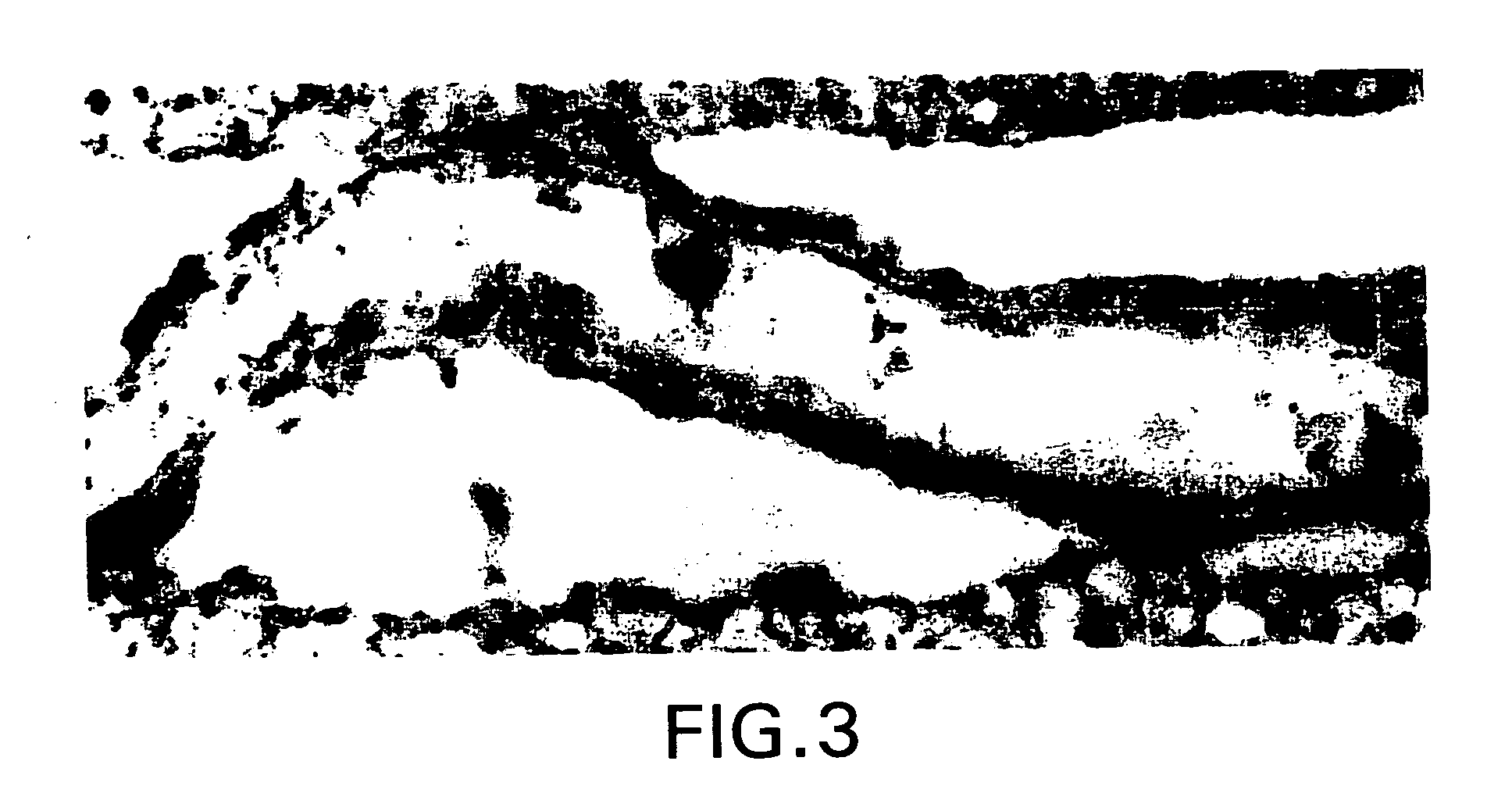 Recombinant tissue protective cytokines and encoding nucleic acids thereof for protection, restoration, and enhancement of responsive cells, tissues, and organs