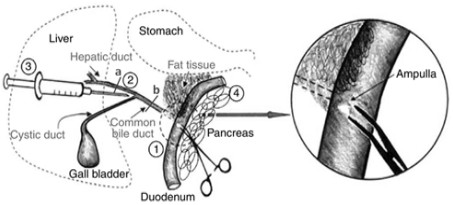 Method for promoting transdifferentiation of pAdM3C infected rat pancreatic duct cells