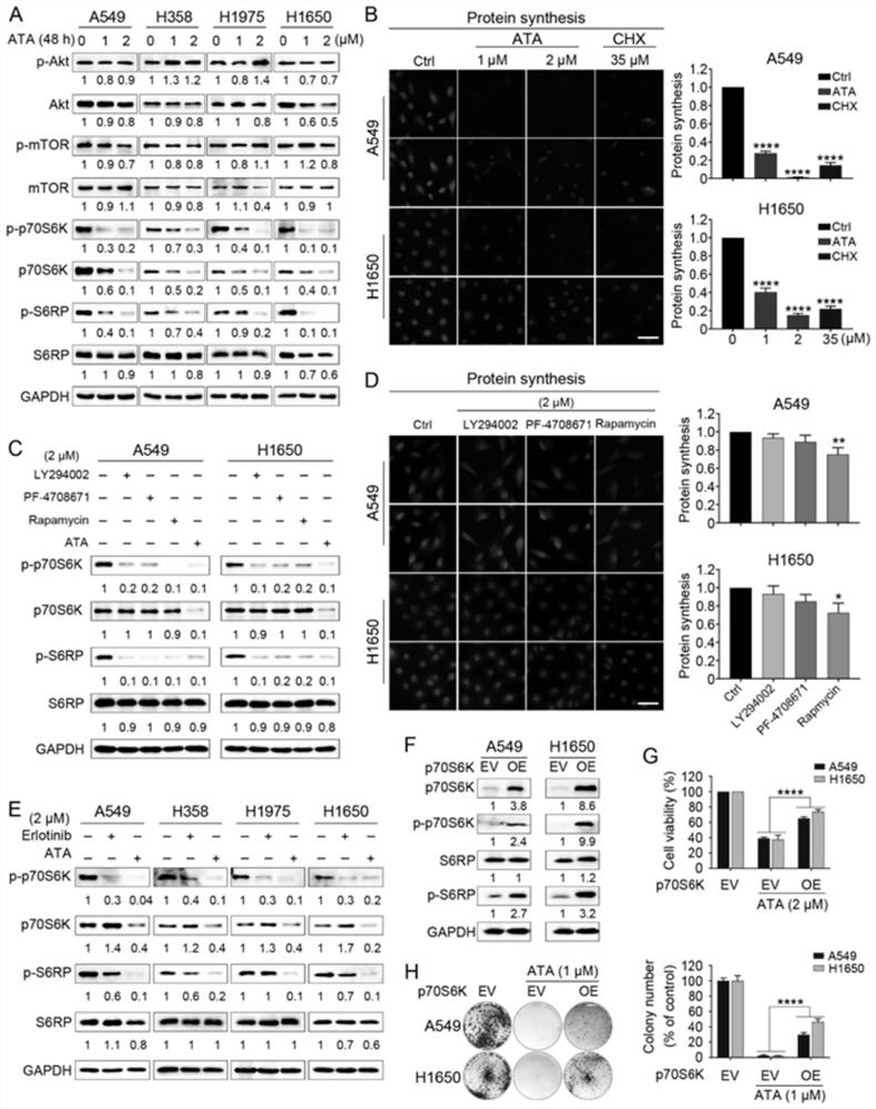 Application of acetyltanshinone IIA in preparation of medicine for treating lung cancer and medicine for treating lung cancer