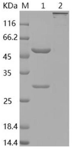 Monoclonal neutralizing antibodies of HPV33L1 (human papillomavirus 33L1) and application of monoclonal neutralizing antibodies