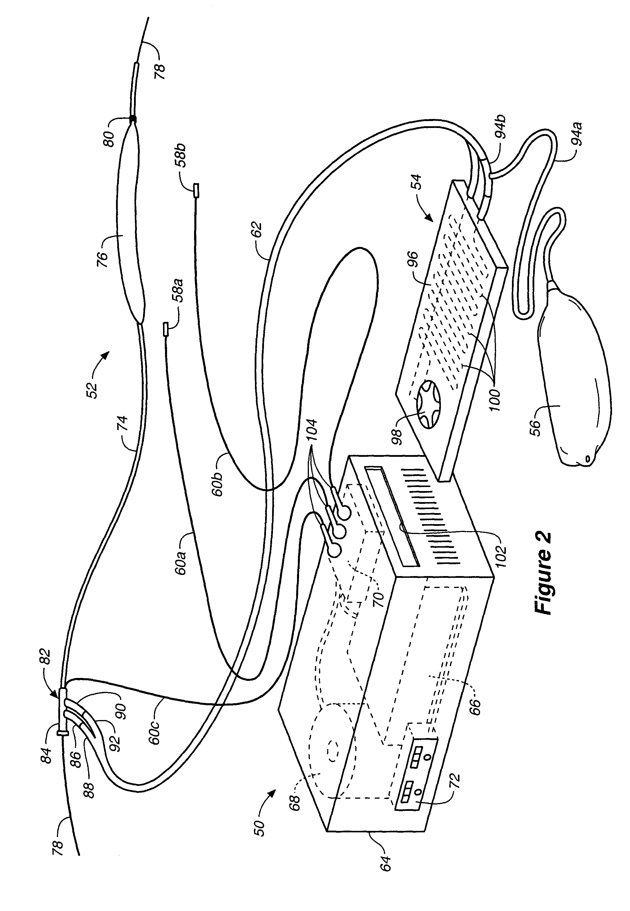 Method and system for control of a patient's body temperature by way of transluminally insertable heat exchange catheter