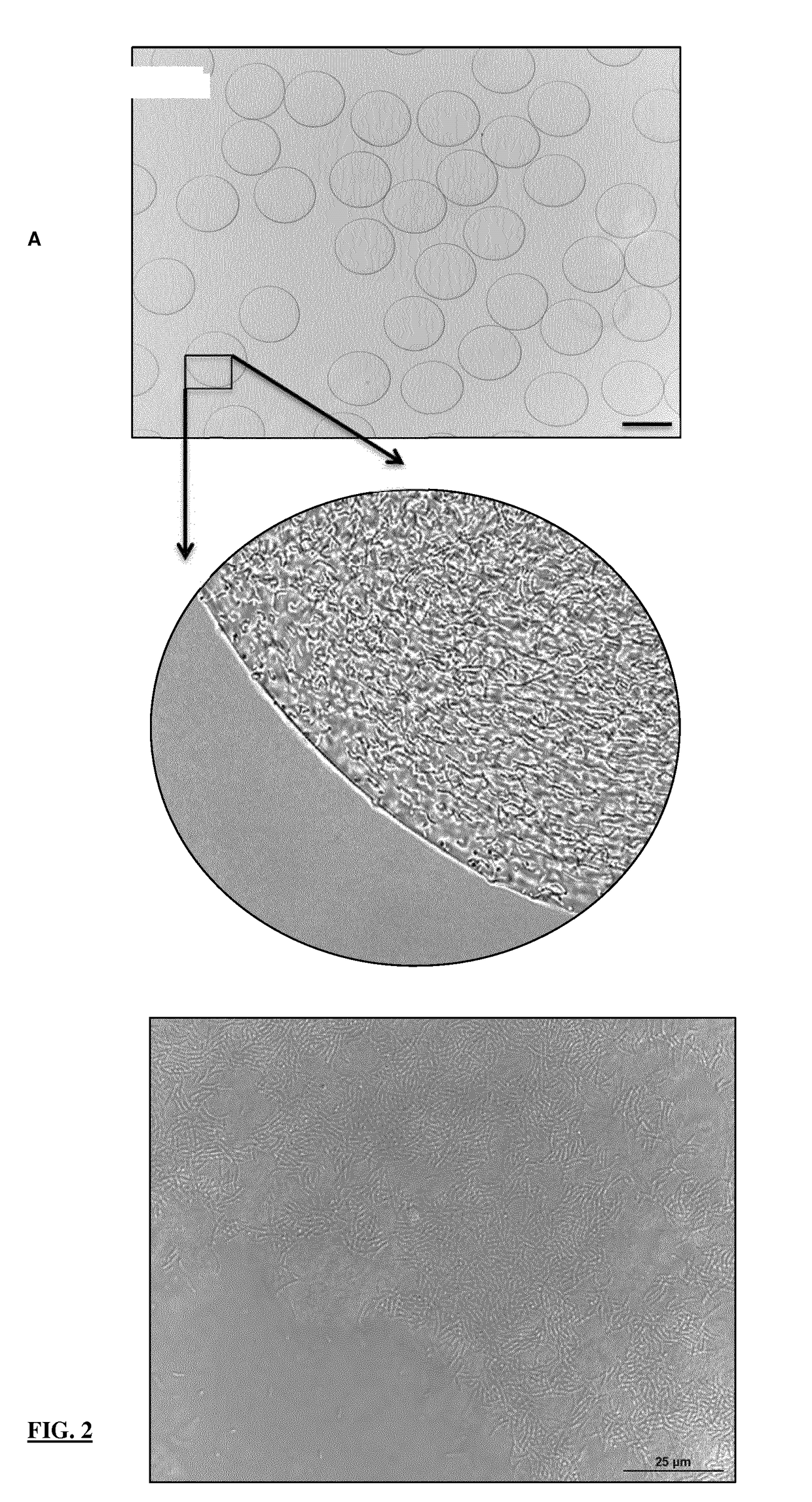 A solution of denatured pea protein, and uses thereof to form microparticles